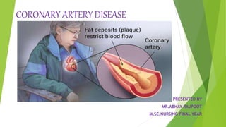 CORONARY ARTERY DISEASE
PRESENTED BY
MR.ABHAY RAJPOOT
M.SC.NURSING FINAL YEAR
 