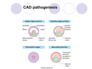 CAD. Angina Pectoris.presentation.ppt.full
