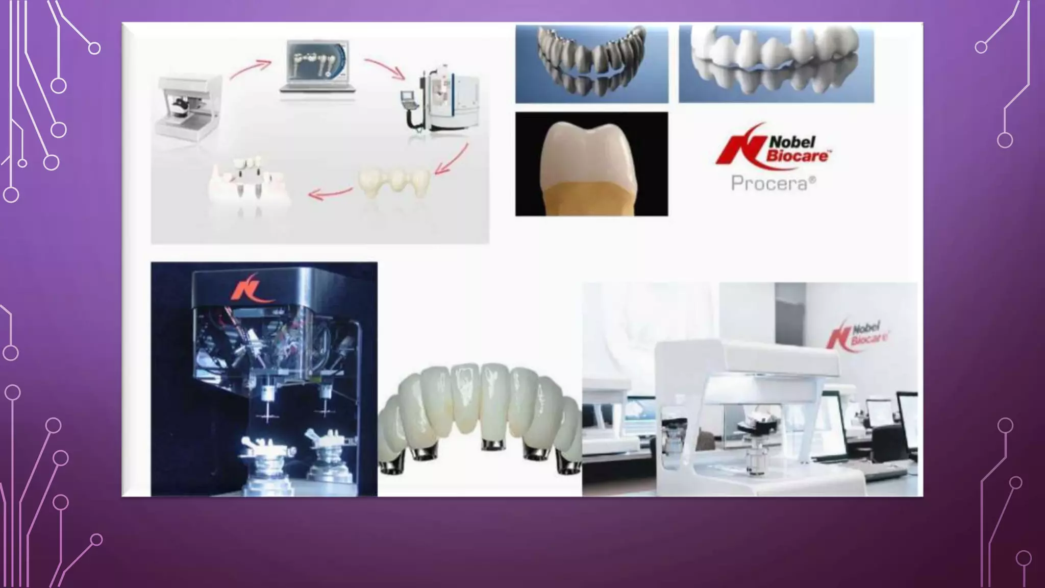 Cad cam in prosthodontics | PPTX