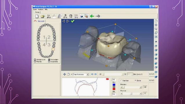 Cad cam in prosthodontics | PPTX