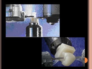 Cad cam and cad-cim in restorative dentistry | PPTX
