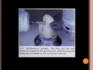 Cad cam and cad-cim in restorative dentistry | PPTX