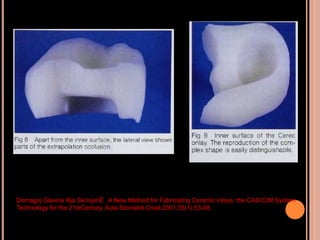 Cad cam and cad-cim in restorative dentistry | PPTX