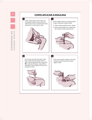 54
                                                        COMO APLICAR A INSULINA

                               Escolher o local para aplicar a insulina. Limpar a pele
                                                                                            Ao iniciar a aplicação da insulina, se for encontrada a presença
                               usando algodão com álcool e deixar secar. Manter uma
                                                                                            de sangue na seringa, seguir as seguintes orientações:
                               distância de mais ou menos 2 cm do local onde você tomou a
                               injeção anterior, se a área do corpo for a mesma.            1) Sangue em pequena quantidade: continuar a aplicação
                                                                                            2) Sangue em grande quantidade: parar a aplicação. Jogue
                                                                                               fora a seringa com a insulina e prepare outra dose.
              ATENÇÃO BÁSICA
CADERNOS DE




                               Fazer uma prega na pele onde você vai aplicar a insulina.     Injetar insulina, empurrando o êmbolo até o final. Retirar
                               Pegar na seringa como se fosse um lápis. Introduzir a         a seringa e fazer uma leve pressão no local, usando o
                               agulha na pele, num ângulo de 90º, soltar a prega cutânea.    algodão com álcool.
                               Obs.: em pessoas muito magras ou crianças menores, a
                               injeção poderá ser feita num ângulo de 45º para evitar que
                               seja aplicada no músculo.
 