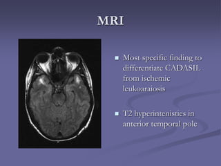 MRI
 Most specific finding to
differentiate CADASIL
from ischemic
leukoaraiosis
 T2 hyperintenisties in
anterior temporal pole
 