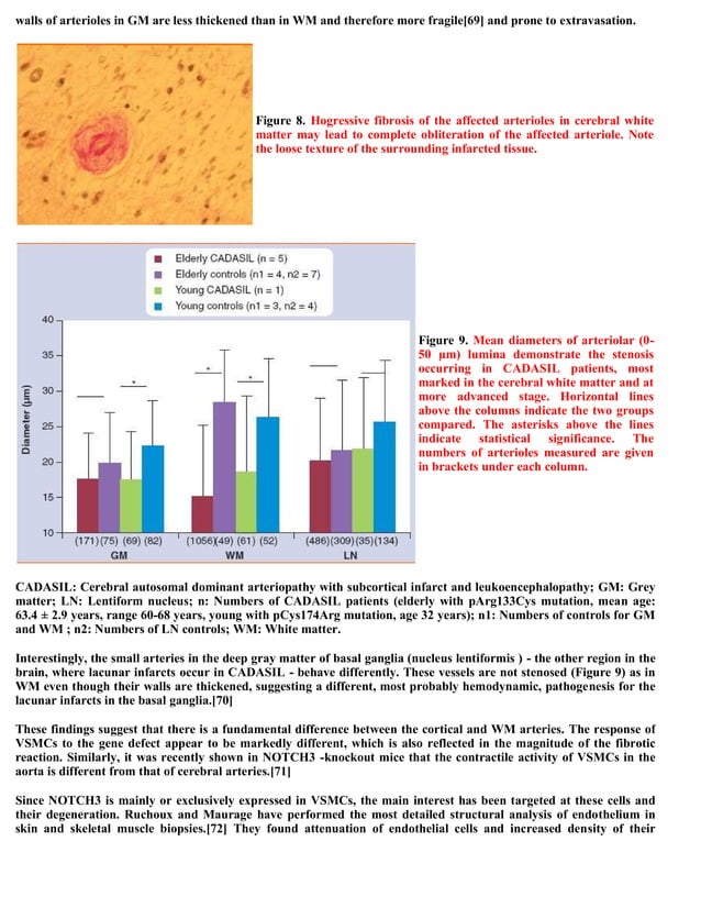 Topic of the month.... Hereditary subcortical vascular dementia (CADASIL)