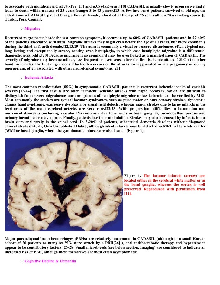 Topic of the month.... Hereditary subcortical vascular dementia (CADA…