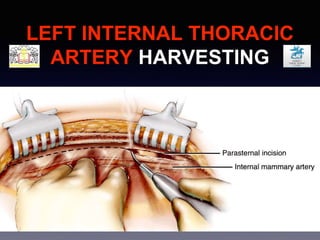 CAD & CABG | PPTX