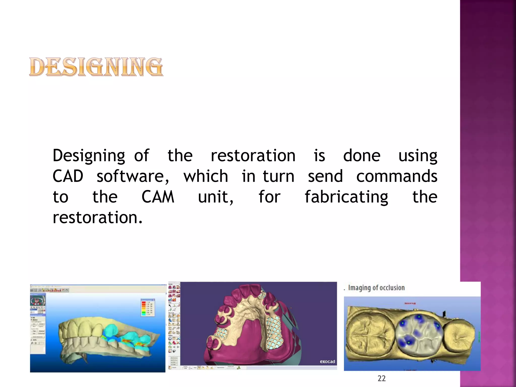 CAD/CAM in prosthetic dentistry | PDF