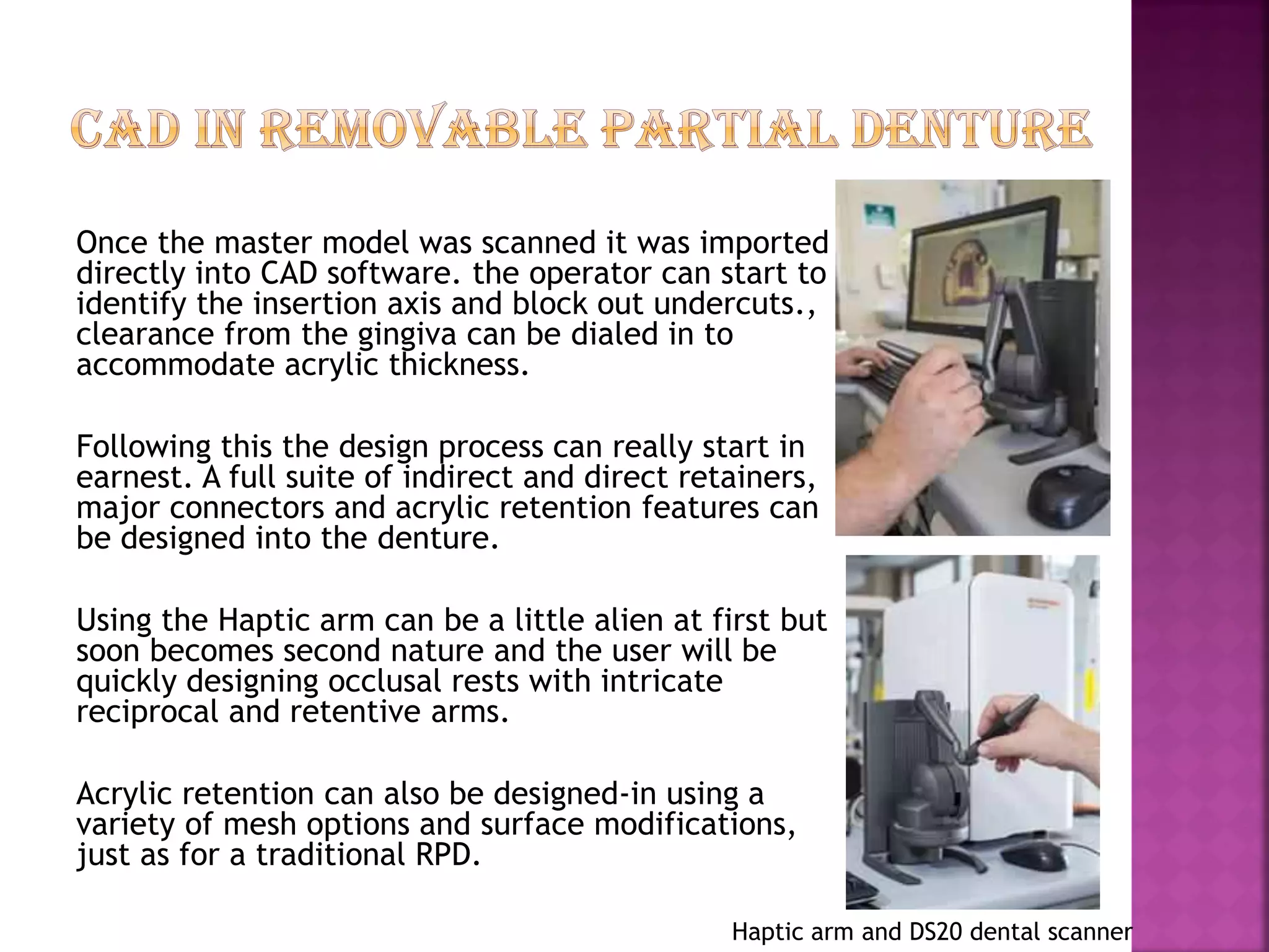 CAD/CAM in prosthetic dentistry | PDF