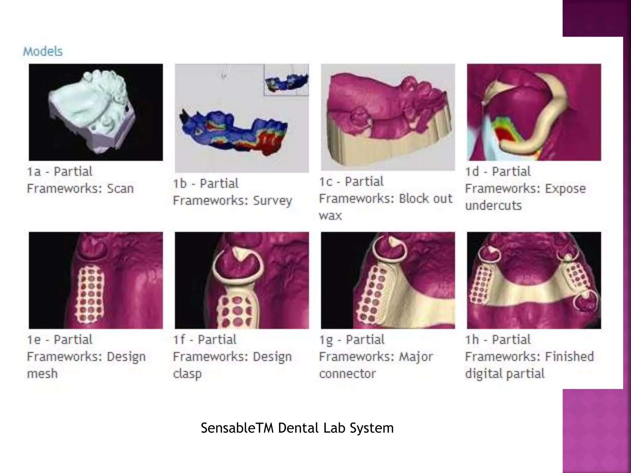 CAD/CAM in prosthetic dentistry | PDF