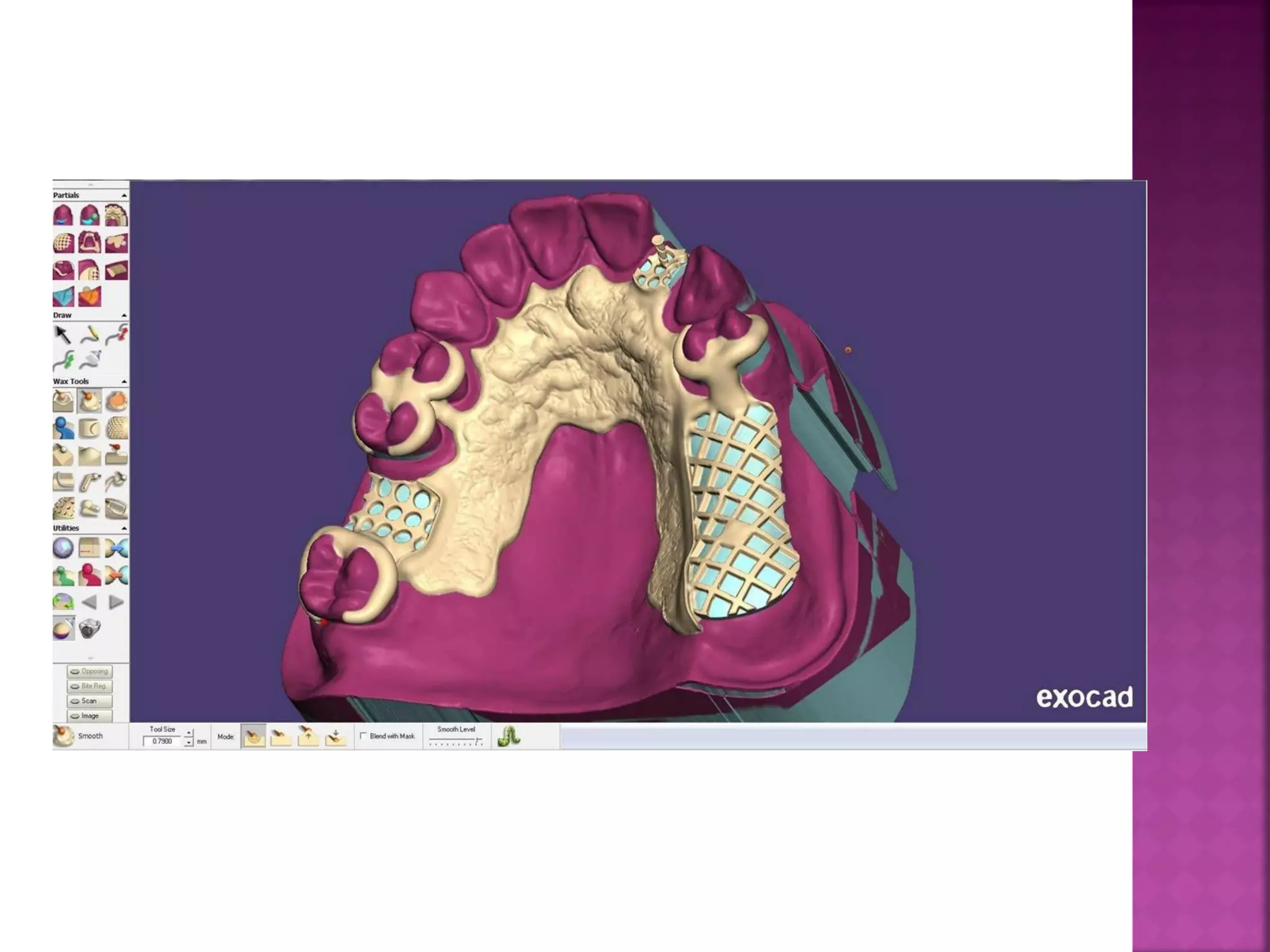 CAD/CAM in prosthetic dentistry | PDF
