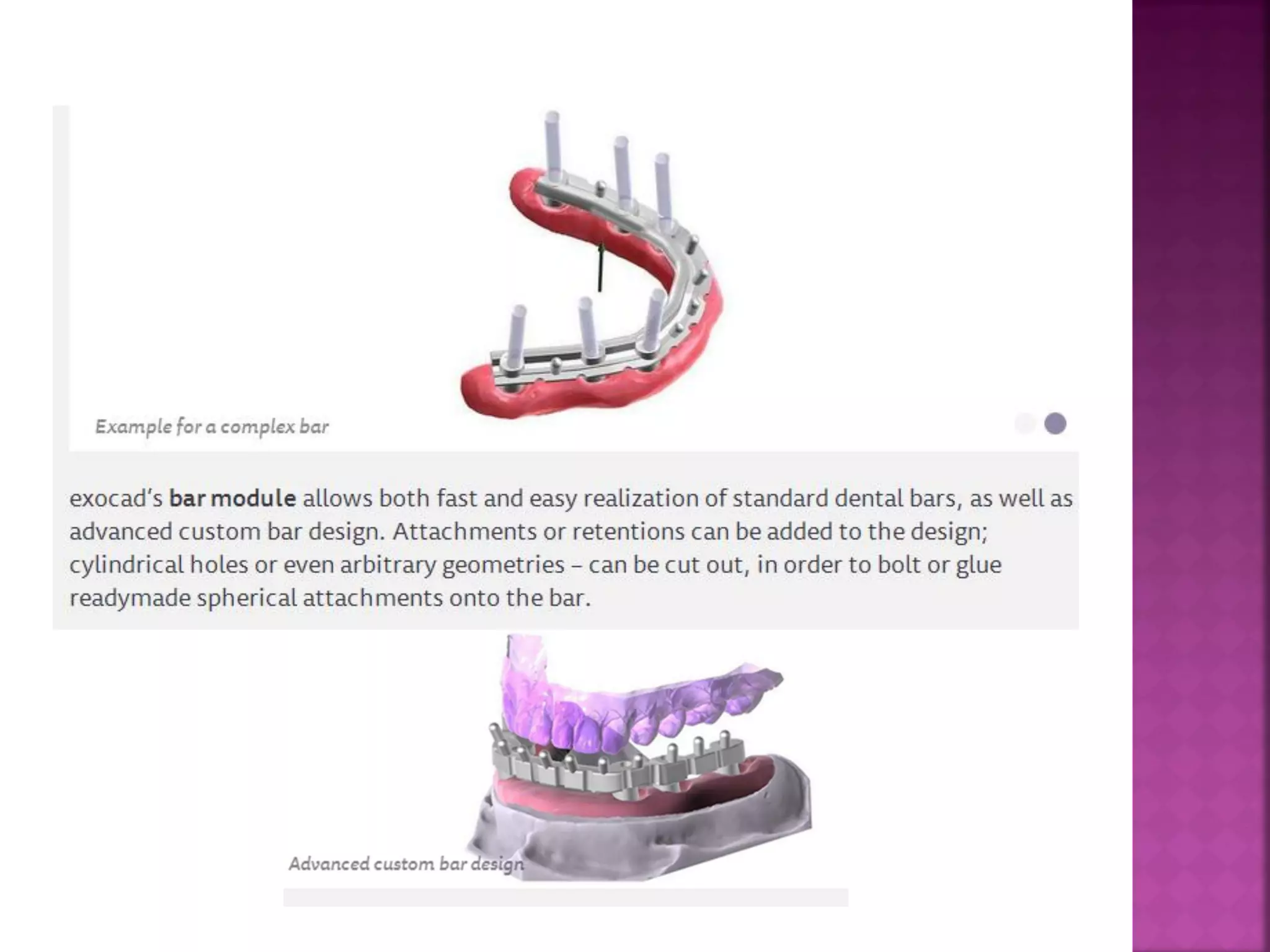 CAD/CAM in prosthetic dentistry | PDF