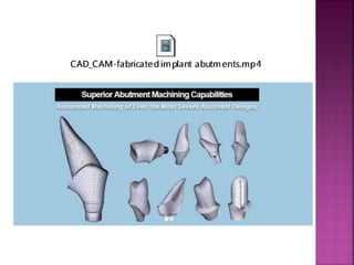 CAD/CAM in prosthetic dentistry | PDF