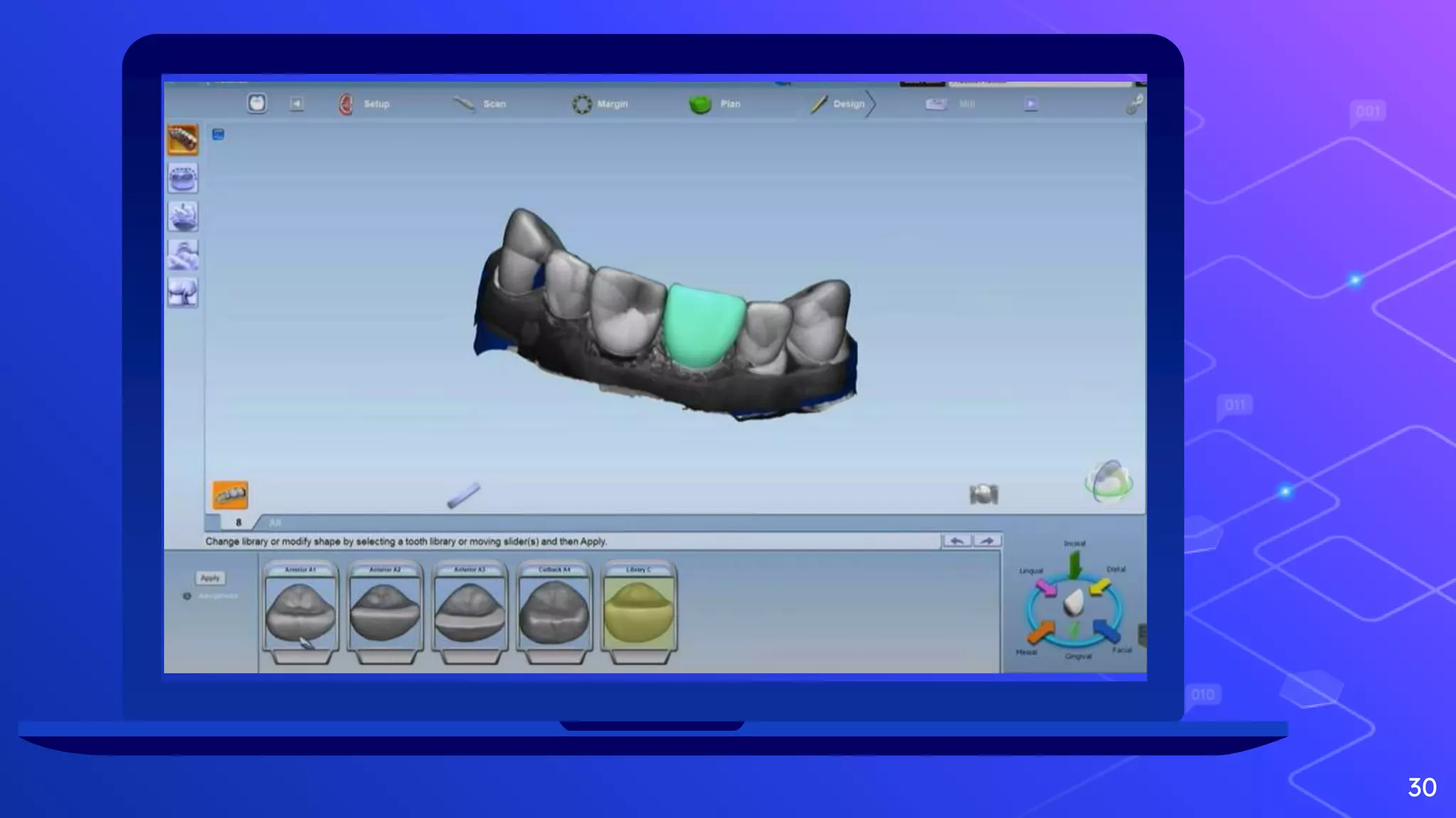 Cadcam in Dentistry | PPTX