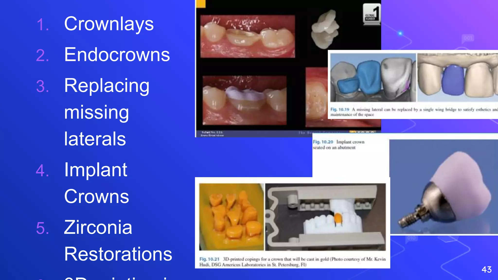 Cadcam in Dentistry | PPTX