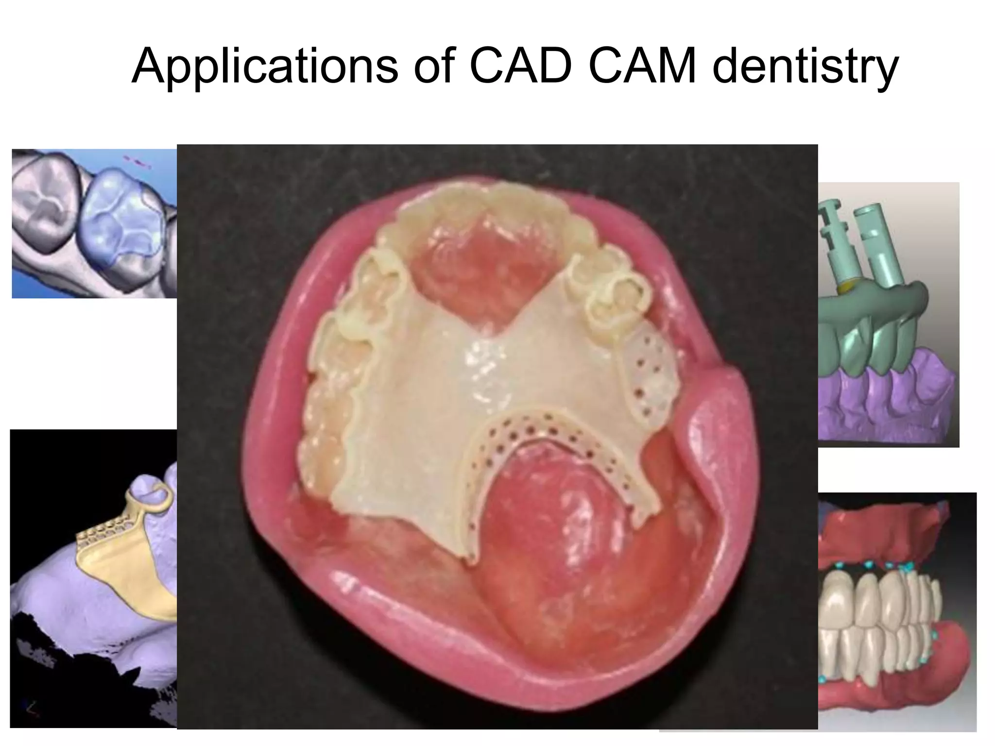 Cad Cam dentistry and digital impressions | PPTX