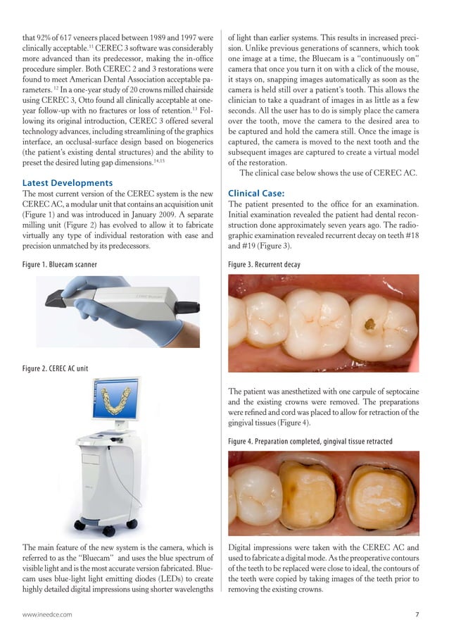 Cad cam digital_impressions till nya tandläkare | PDF | Oral care ...
