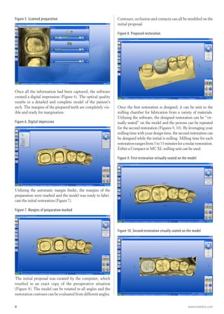 Cad cam digital_impressions till nya tandläkare | PDF | Oral care ...
