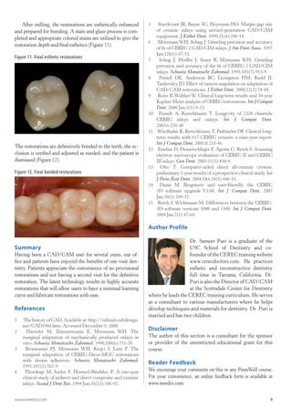 Cad cam digital_impressions till nya tandläkare | PDF | Oral care ...