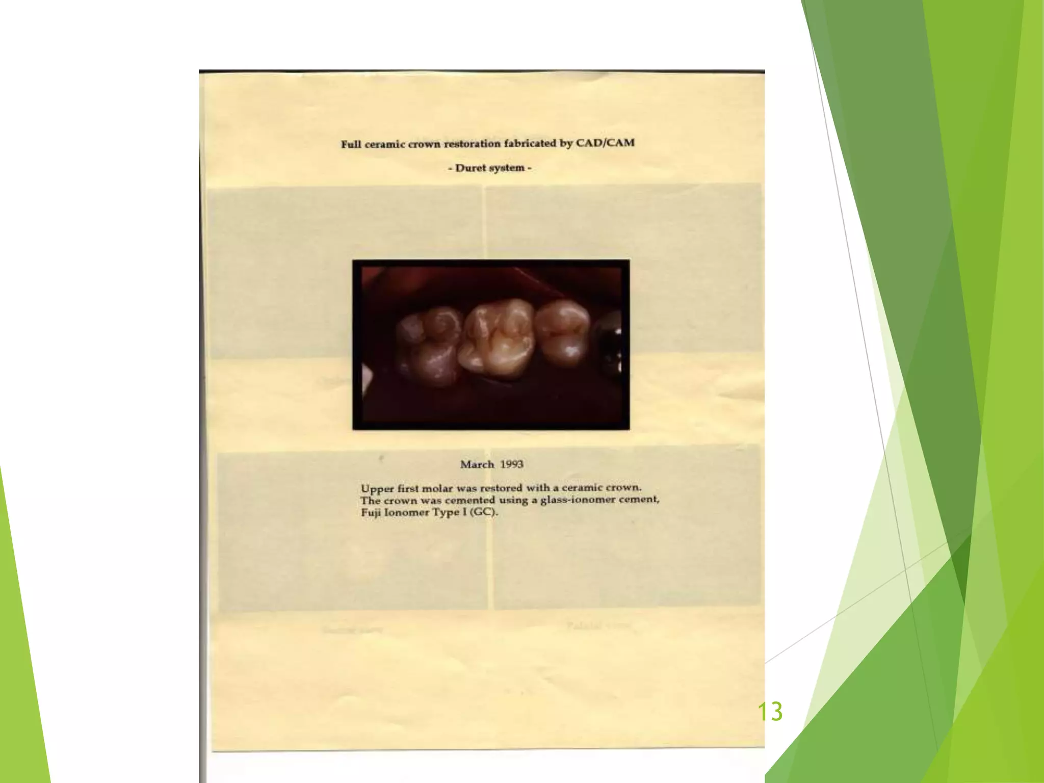 Cad cam in prosthodontics | PPTX