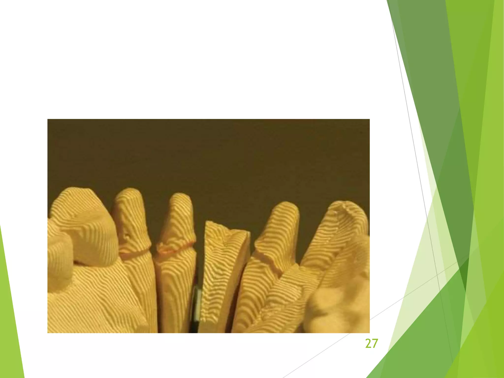 Cad cam in prosthodontics | PPTX