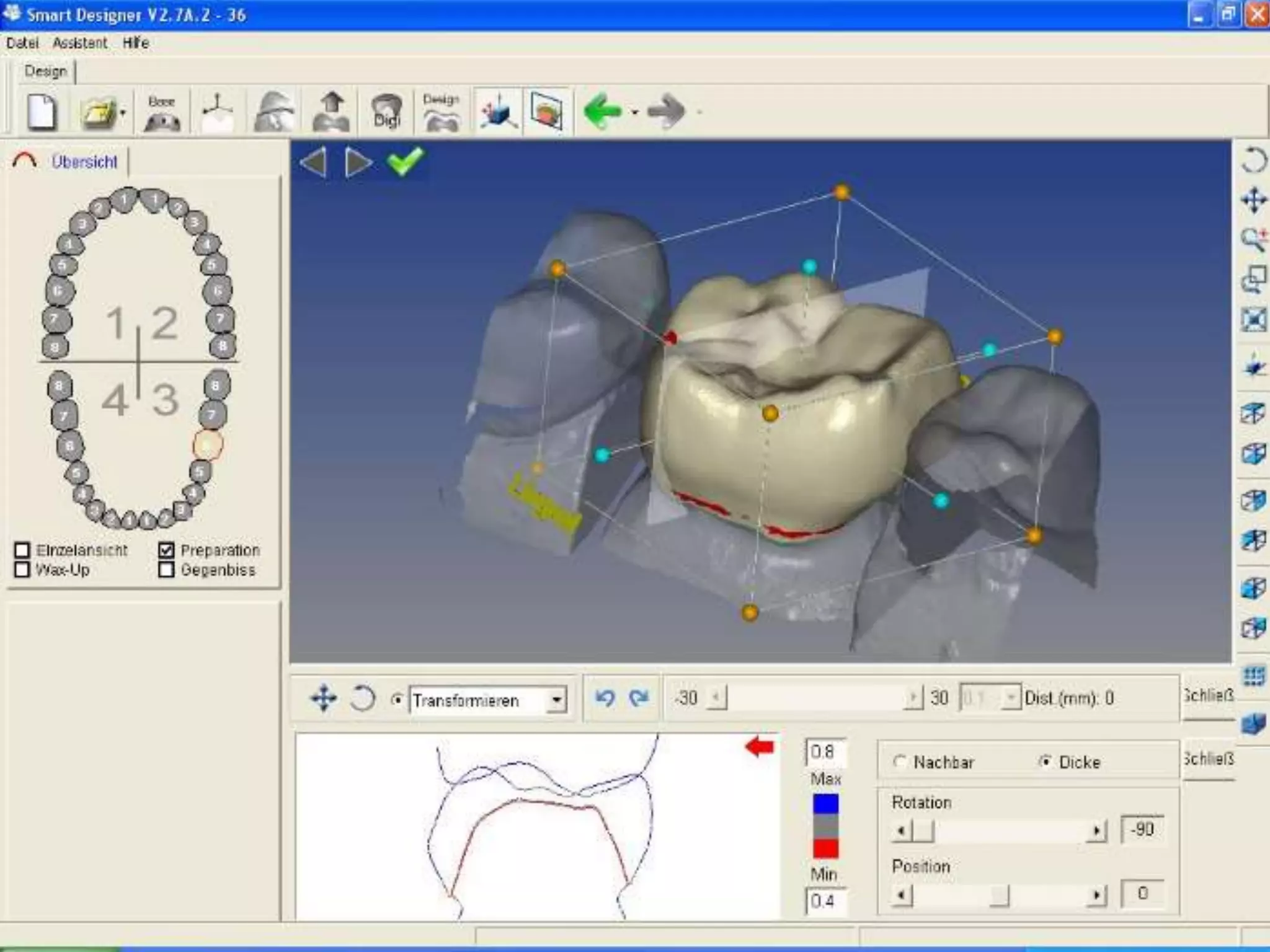 Cad cam in prosthodontics | PPTX