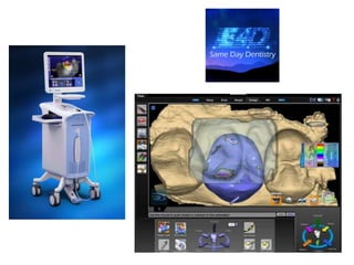Cad cam in prosthodontics | PPTX