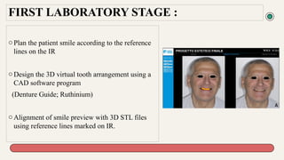 Innovative CAD-CAM Digital Denture Workflow Enhancing Clinical ...