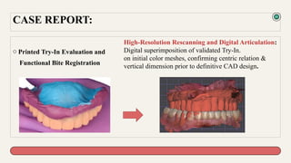 Innovative CAD-CAM Digital Denture Workflow Enhancing Clinical ...