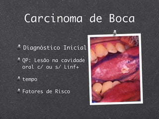 Carcinoma de Boca
Diagnóstico Inicial
QP: Lesão na cavidade
oral c/ ou s/ Linf+
tempo
Fatores de Risco
 