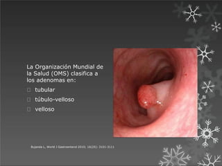 La Organización Mundial de
la Salud (OMS) clasifica a
los adenomas en:
tubular
túbulo-velloso
velloso
Bujanda L, World J Gastroenterol 2010; 16(25): 3101-3111
 