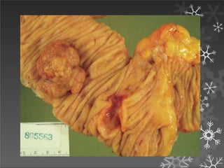 American Cancer Society; 2012
 