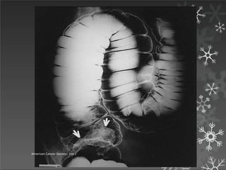 American Cancer Society; 2012
 