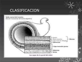 CLASIFICACION
American Cancer Society; 2012
 