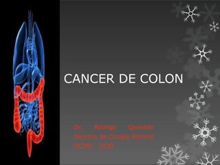 CANCER DE COLON
Dr. Rodrigo Quevedo
Servicio de Cirugia General
HCIPS - 2020
 