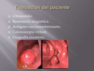  Ultrasonido.
 Resonancia magnética.
 Antígeno carcinoembrionario.
 Colonoscopia virtual.
 Urografía excretora.
 