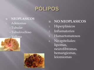  NEOPLASICOS
1. Adenomas
- Tubular
- Tubulovelloso
- Velloso
 NO NEOPLASICOS
1. Hiperplásicos
2. Inflamatorios
3. Hamartomatosos
4. No epiteliales:
lipomas,
neurofibromas,
hemangiomas,
leiomiomas
 