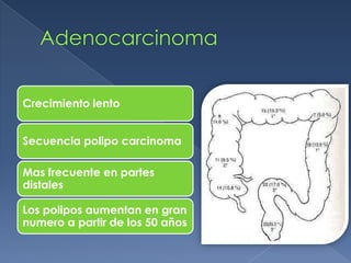 Crecimiento lento


Secuencia polipo carcinoma

Mas frecuente en partes
distales

Los polipos aumentan en gran
numero a partir de los 50 años
 