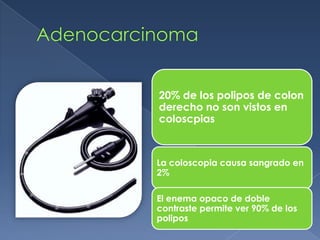20% de los polipos de colon
derecho no son vistos en
coloscpias



La coloscopia causa sangrado en
2%

El enema opaco de doble
contraste permite ver 90% de los
polipos
 