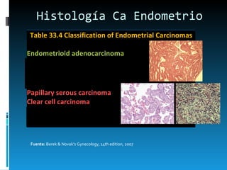 Histología Ca Endometrio Fuente:  Berek & Novak’s Gynecology, 14th edition, 2007 Table 33.4 Classification of Endometrial Carcinomas Endometrioid adenocarcinoma     Villoglandular or papillary     Secretory     Adenoacantoma (squamous differentiation)    25% Mucinous carcinoma Papillary serous carcinoma Clear cell carcinoma Squamous carcinoma Undifferentiated carcinoma Mixed carcinoma 