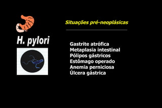 Situações pré-neoplásicas



 Gastrite atrófica
 Metaplasia intestinal
 Pólipos gástricos
 Estômago operado
 Anemia perniciosa
 Úlcera gástrica
 