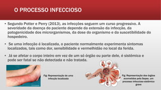 O PROCESSO INFECCIOSO
▪ Segundo Potter e Perry (2013), as infecções seguem um curso progressivo. A
severidade da doença do paciente depende da extensão da infecção, da
patogenicidade dos microrganismos, da dose do organismo e da suscetibilidade do
hospedeiro.
▪ Se uma infecção é localizada, o paciente normalmente experimenta sintomas
localizados, tais como dor, sensibilidade e vermelhidão no local da ferida.
▪ Já se afetar o corpo inteiro em vez de um só órgão ou parte dele, é sistêmica e
pode ser fatal se não detectada e não tratada.
Fig: Representação de uma
infecção localizada
Fig: Representação dos órgãos
acometidos pela Sepse, um
processo infeccioso sistêmico
grave
 