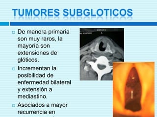 TOMOGRAFÍA AXIAL COMPUTARIZADA