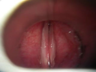 TOMOGRAFÍA AXIAL COMPUTARIZADA