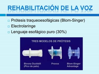 Laringectomia totalIndicaciones:T3 o T4 que no son candidatos a laringectomía parcial.Involucro extenso de los cartílagos tiroides o cricoides.Invasión del cuello o sus tejidos blandos.Involucro de la base de lengua más allá de las papilas circunvaladas.