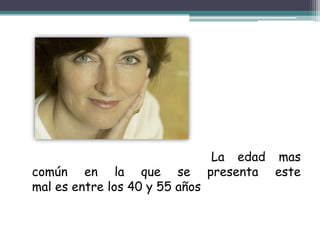 La edad mas
común en la que se              presenta este
mal es entre los 40 y 55 años
 