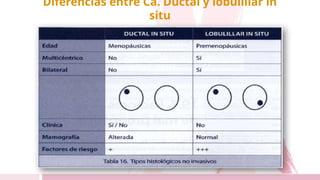 Diferencias entre Ca. Ductal y lobulillar in
situ
 