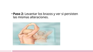 • Paso 2: Levantar los brazos y ver si persisten
las mismas alteraciones.
 