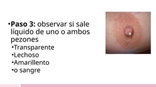 •Paso 3: observar si sale
líquido de uno o ambos
pezones
•Transparente
•Lechoso
•Amarillento
•o sangre
 